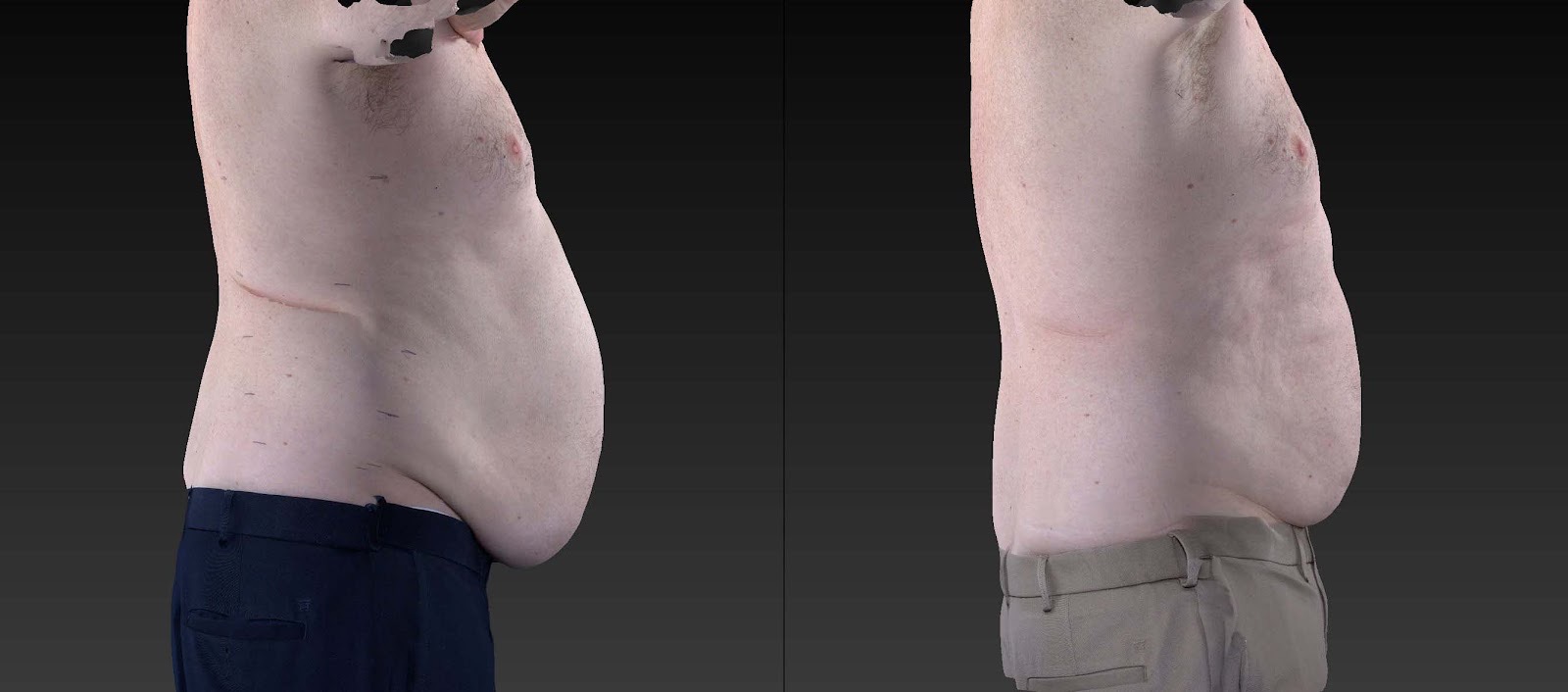 Side view of a person's torso with protruding abdomen, wearing dark pants, against a dark background.