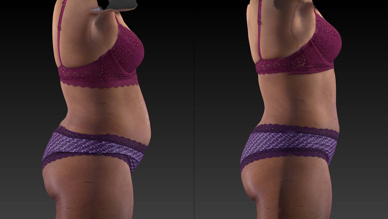 Side view of a woman in purple bra and underwear, showing her abdomen and hips, against a black background.