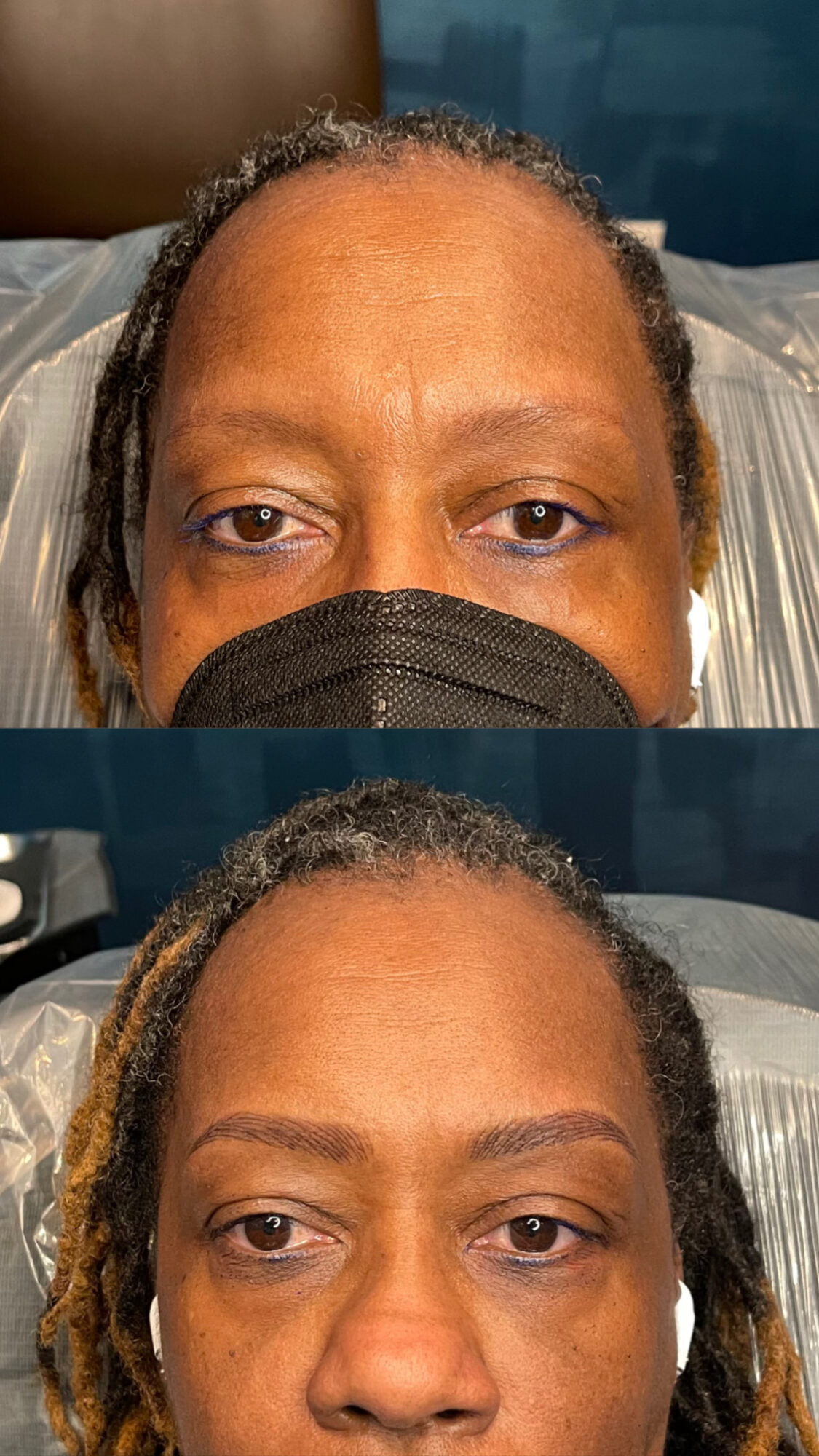 Close-up of a person's face with a black mask, showing eyes and forehead, before and after hair treatment.