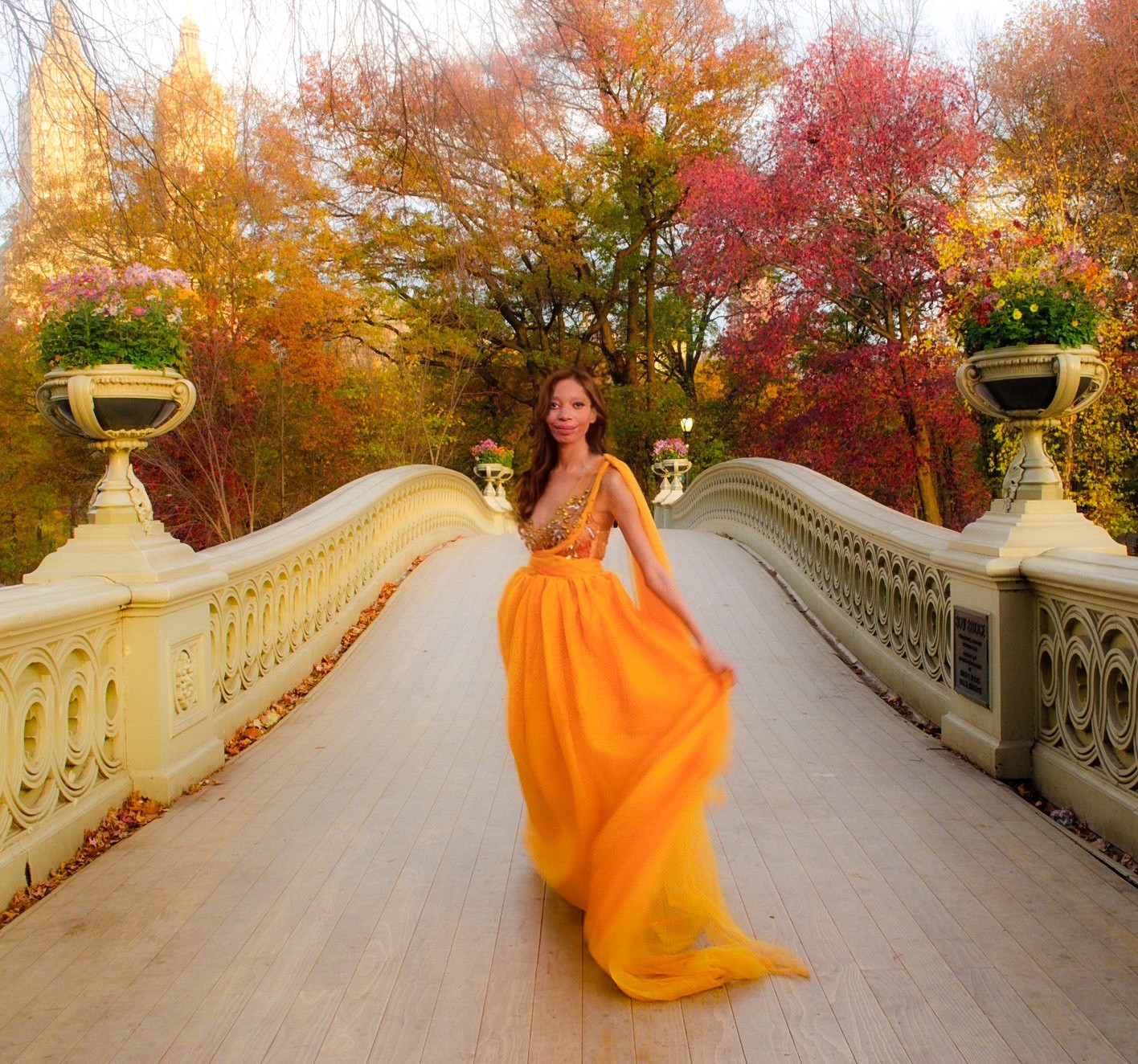 Woman in a yellow dress walking on a bridge with autumn trees in background.