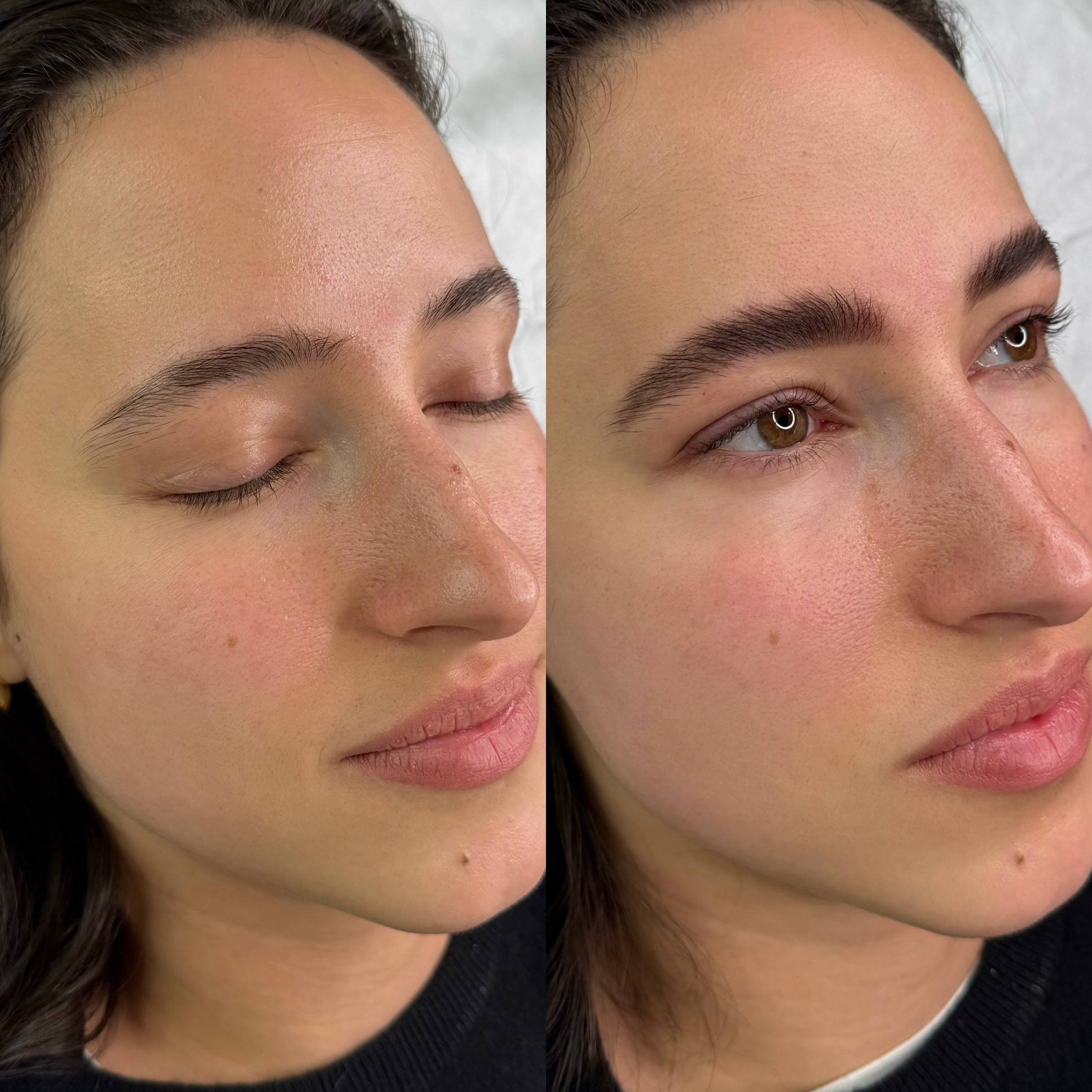 Side-by-side close-up of a woman's face, one with eyes closed and the other with eyes open, showing skin details.