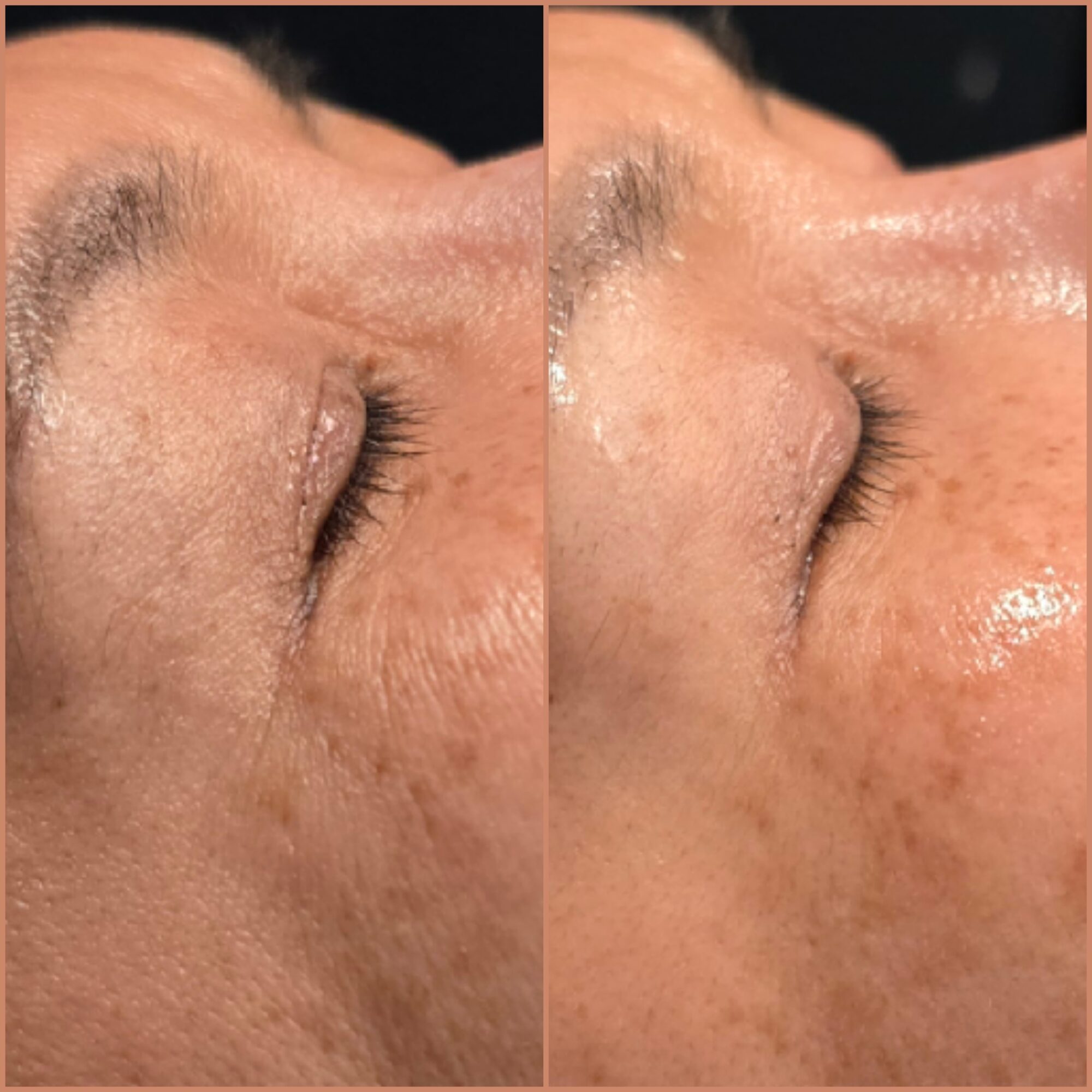 Side-by-side close-ups of a person's closed eye, eyebrow, and upper cheek.