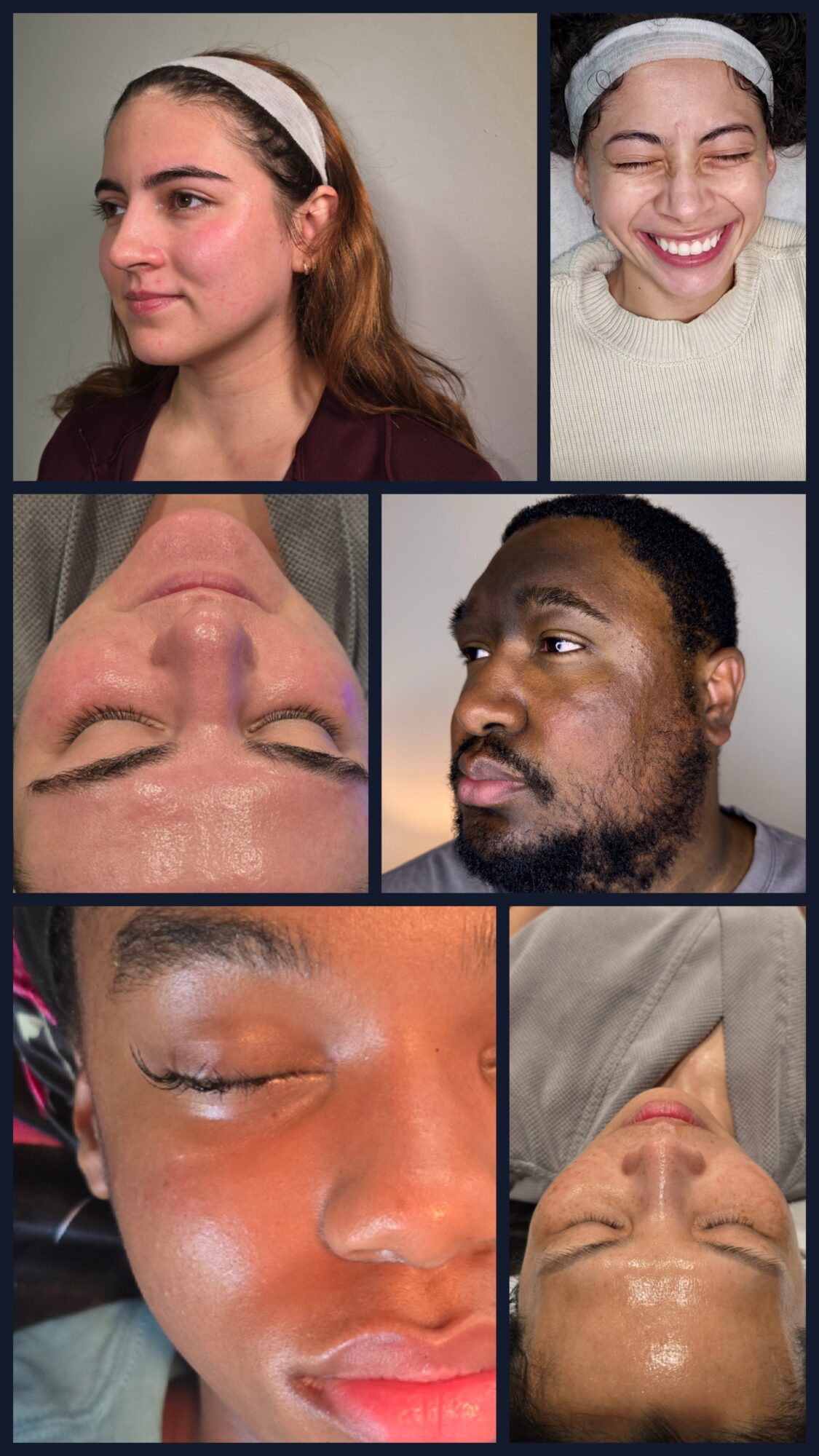Collage of five close-up portraits showing faces before and after cosmetic procedures.